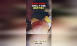 缅北医生爆料视频播放全集,视频全集深度解析